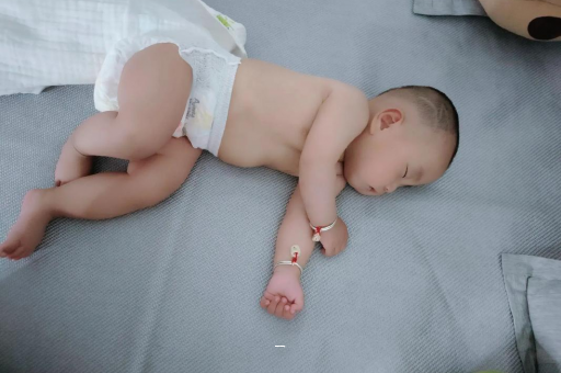 柳州宝宝脸上有白色斑块 柳州宝宝脸上有白色斑块